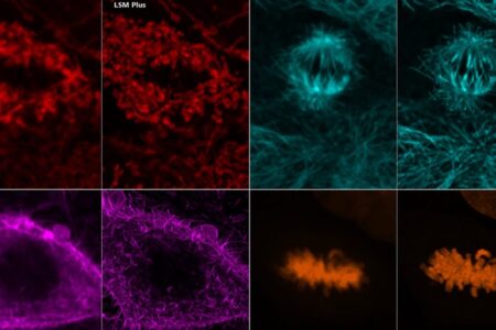 Zeiss: Improved Image Quality and Resolution for all ZEISS Laser Scanning Microscopes
